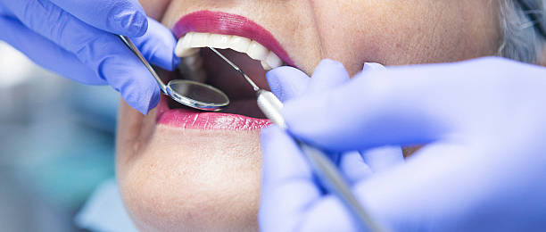 Best Emergency Treatment for Dental Infections or Abscesses in Penn Estates, PA